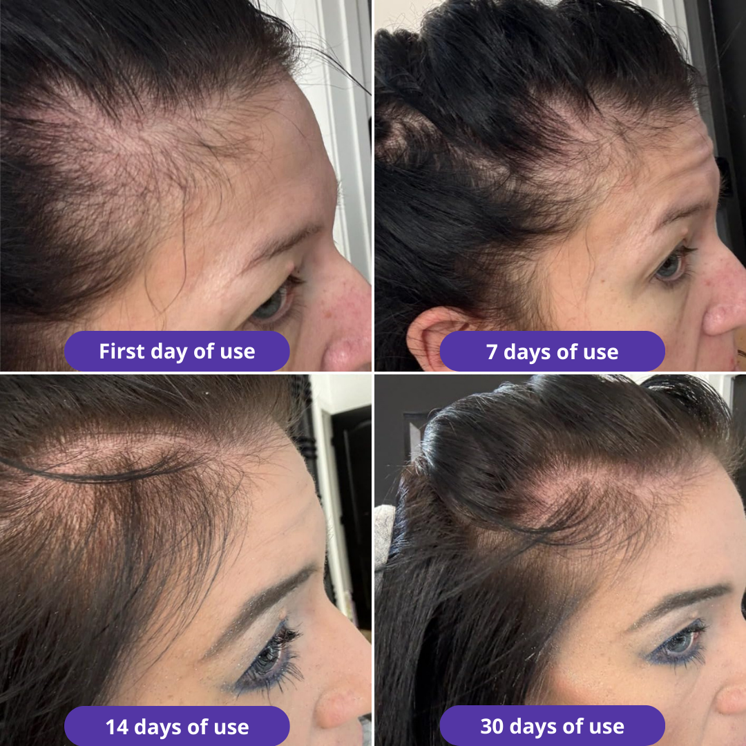 HerGrow™ Natural Hair Growth Serum Oil