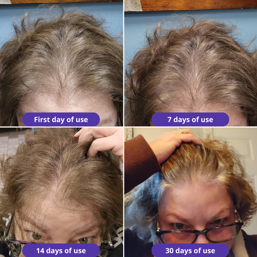 HerGrow™ Natural Hair Growth Serum Oil