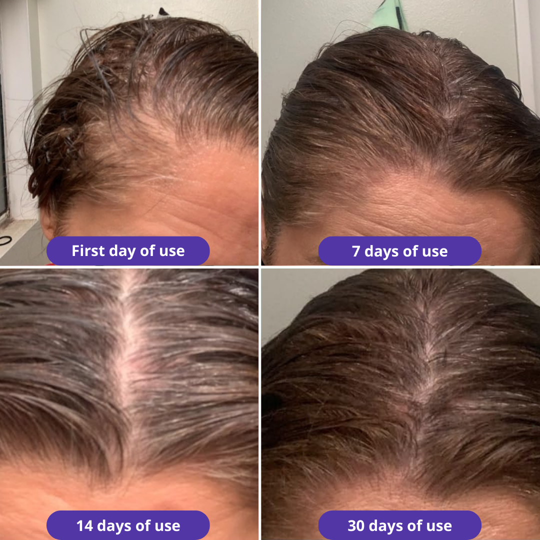 HerGrow™ Natural Hair Growth Serum Oil